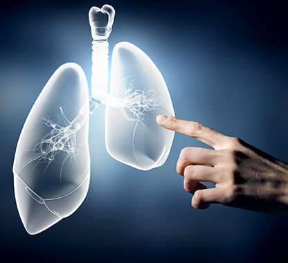 Assessing viability of entering the NSCLC market